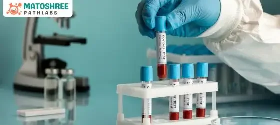 Best Pathology blood test center in Pimpri chinchwad and Pune – Matoshree Pathlabs Best Pathology blood test center in Pimpri chinchwad and Pune - Matoshree Pathlabs