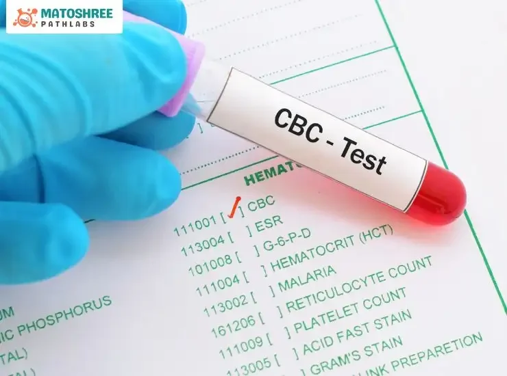 CBC Test in Pune near Wakad at low cost – Matoshree Pathlabs, Pune CBC Test in Pune near Wakad at low cost - Matoshree Pathlabs, Pune