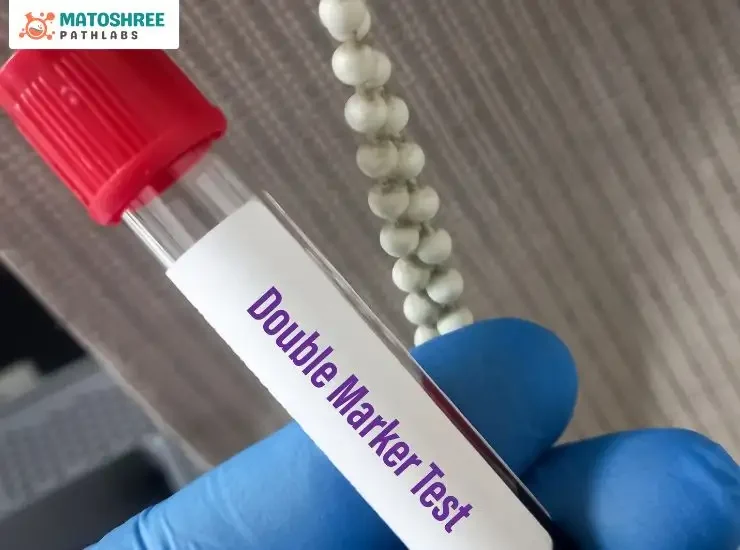 Cost of Double marker test in Pune – Explained by Matoshree Pathlabs Pune Cost of Double marker test in Pune - Explained by Matoshree Pathlabs Pune
